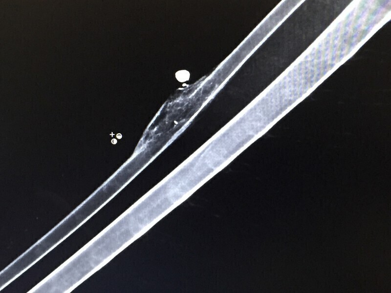 Zdjęcie 6: Ranny orzeł znaleziony w naszym regionie