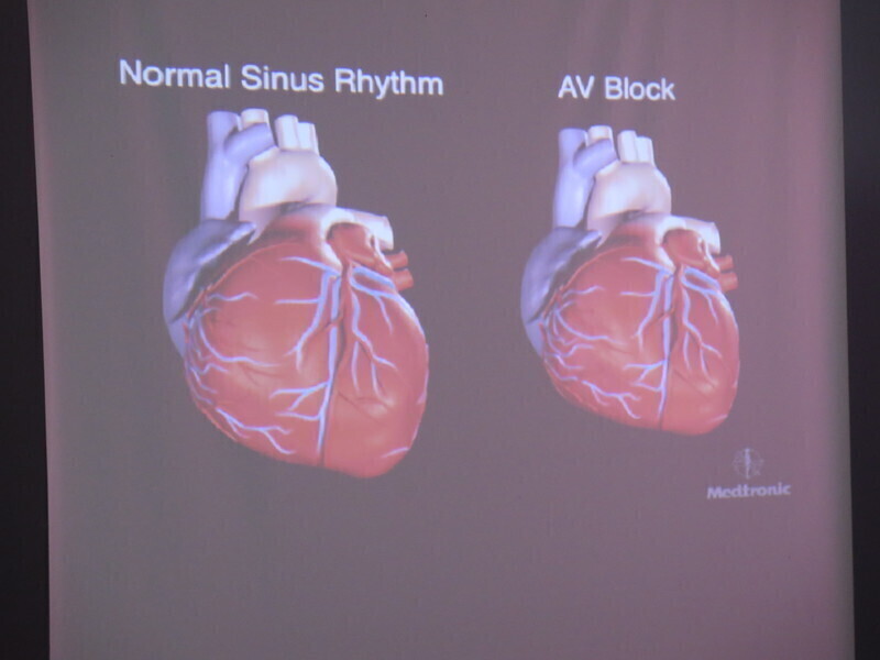 Zdjęcie 14: Rozruszniki serca niebawem na Rakowskiej