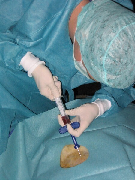 Ilu piotrkowian gotowych ratować czyjeś życie