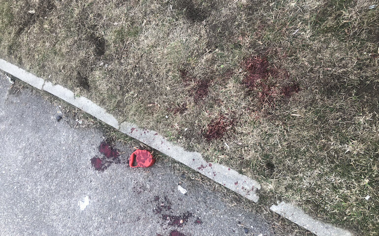 Agresywny pies zaatakował człowieka i innego czworonoga