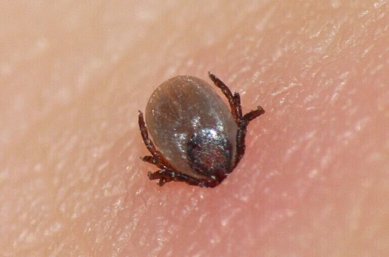 Wbije się w skórę a ty nawet nie poczujesz