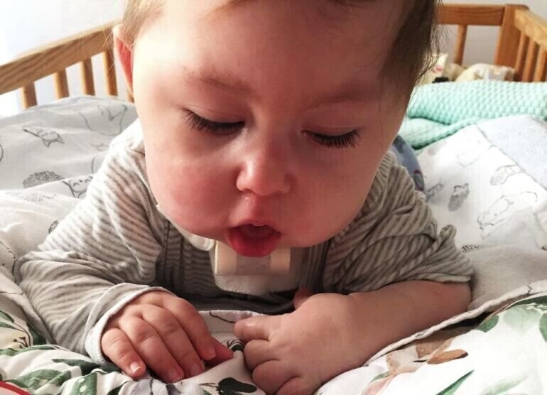 Na pomoc Alicji. Będzie zbiórka charytatywna na Polance w Sulejowie