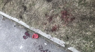 Agresywny pies zaatakował człowieka i innego czworonoga