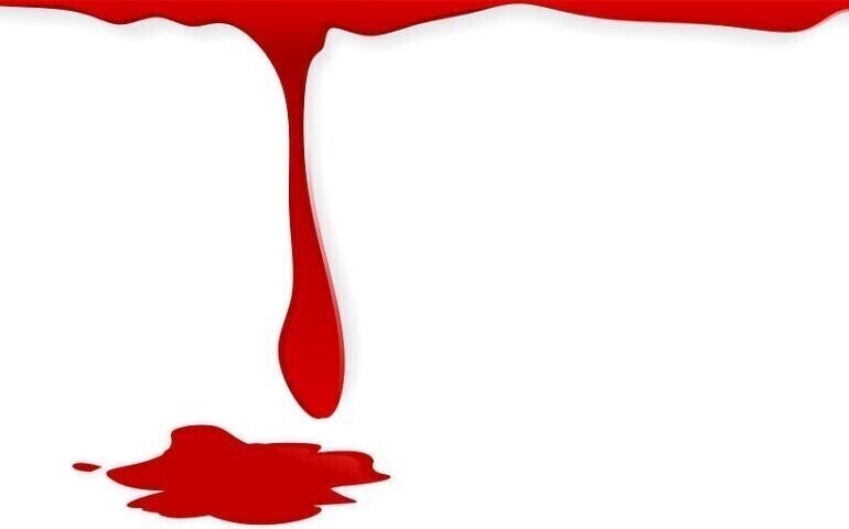 Potrzebna krew dla kobiety która ucierpiała podczas zderzenia z uciekającym złodziejem auta