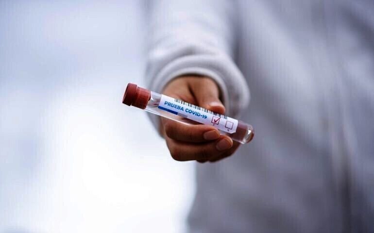 Covid-19 Sobotni raport służb wojewody łódzkiego