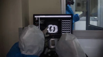 Badania: COVID-19 atakuje nie tylko płuca, wpływa również na mózg, nerki czy serce