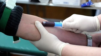 Nie każdy „dobry” cholesterol jest korzystny dla zdrowia