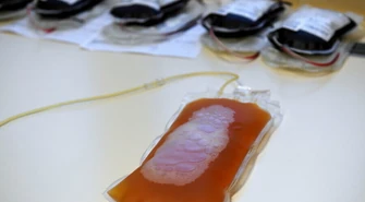 Prof. Radziwon: znów potrzeba osocza od ozdrowieńców, nie ma zapasów