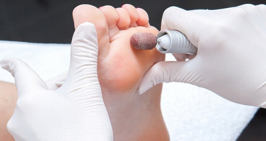 Podolog - specjalista który zadba o twoje stopy