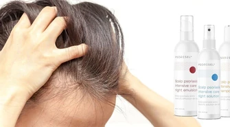 Łuszczyca głowy- na czym polega?