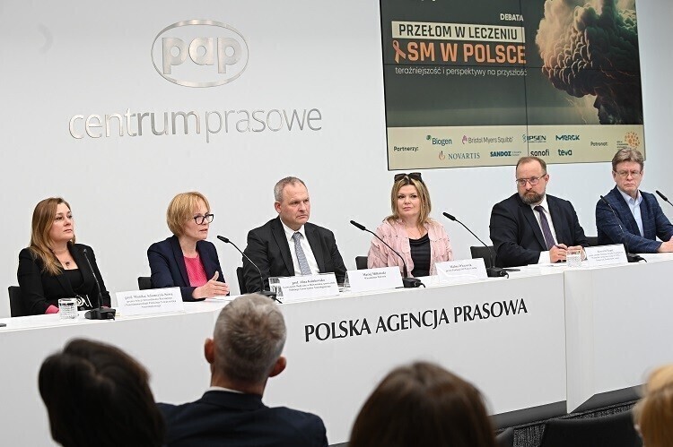 Zaburzenia czucia przewlekłe zmęczenie pierwsze objawy SM mogą być dyskretne