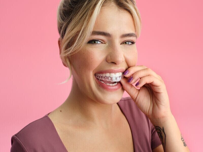 Prostowanie zębów bez stałego aparatu To możliwe