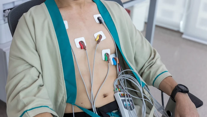 Rozmieszczenie elektrod przy badaniu holterem EKG