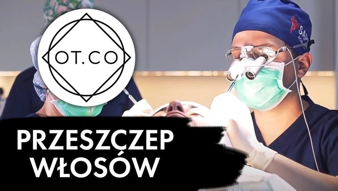 Przeszczep włosów krok po kroku