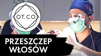 Przeszczep włosów krok po kroku