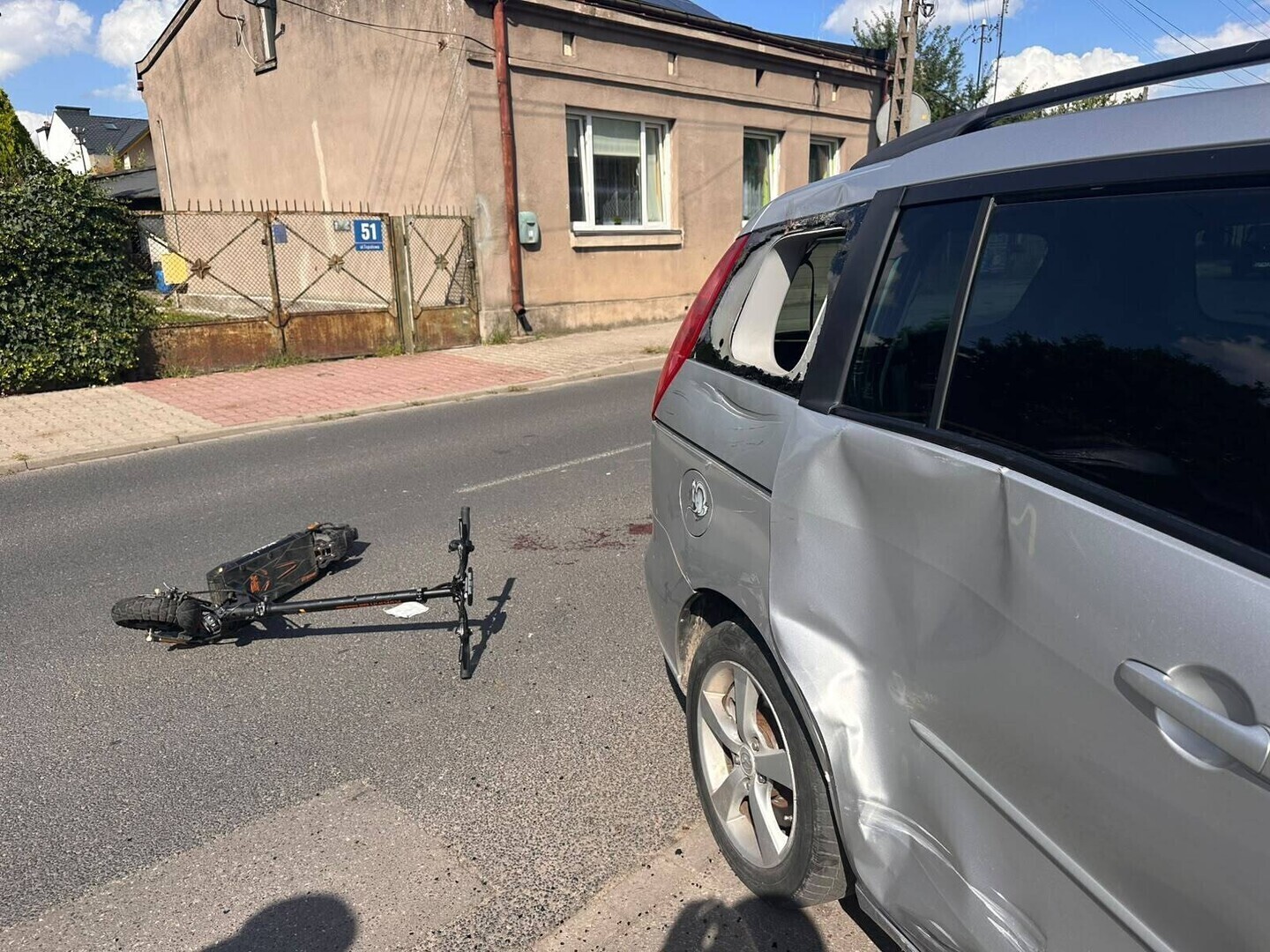 Bez kasku uderzył hulajnogą w samochód. 16-latek trafił do szpitala