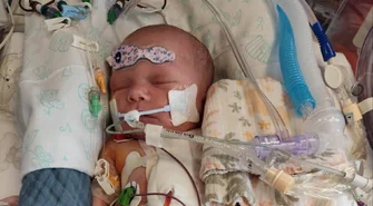 Ciężka, złożona wada serca od pierwszych dni życia. Trwa zbiórka na leczenie Leona